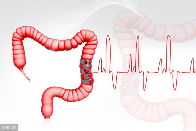 结肠癌高发，想要去预防，要坚持3种方法