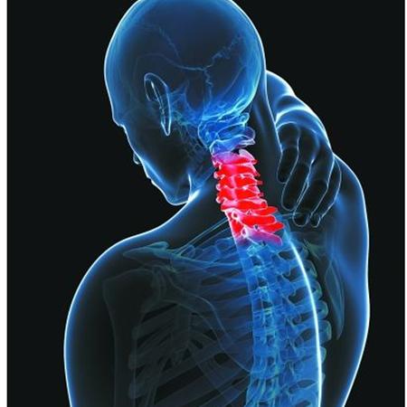 颈椎病日常保健5大招你知道吗