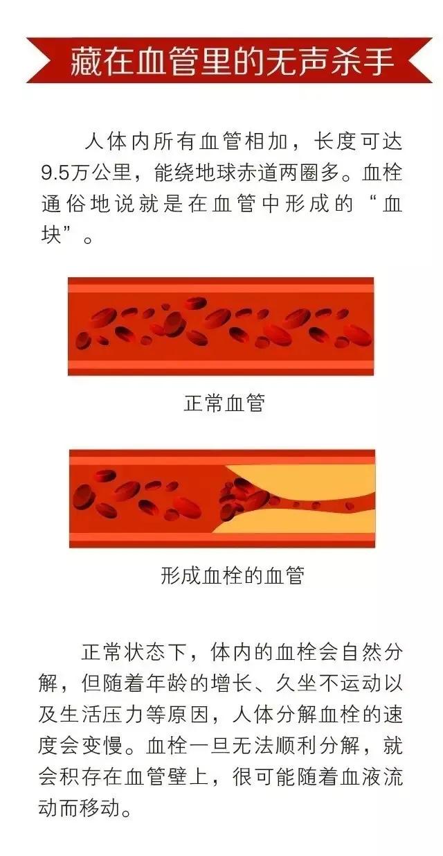 茶水是最好的“抗血栓药”？远离血栓，五点秘诀要记本上