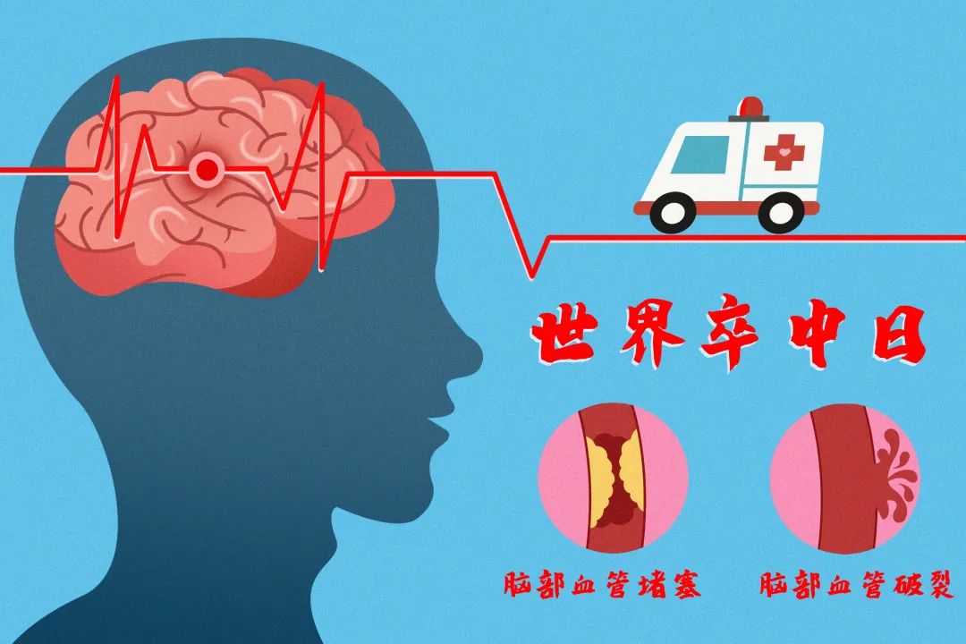 【慢病防控】每四个人中就会发生！这种疾病重在预防！