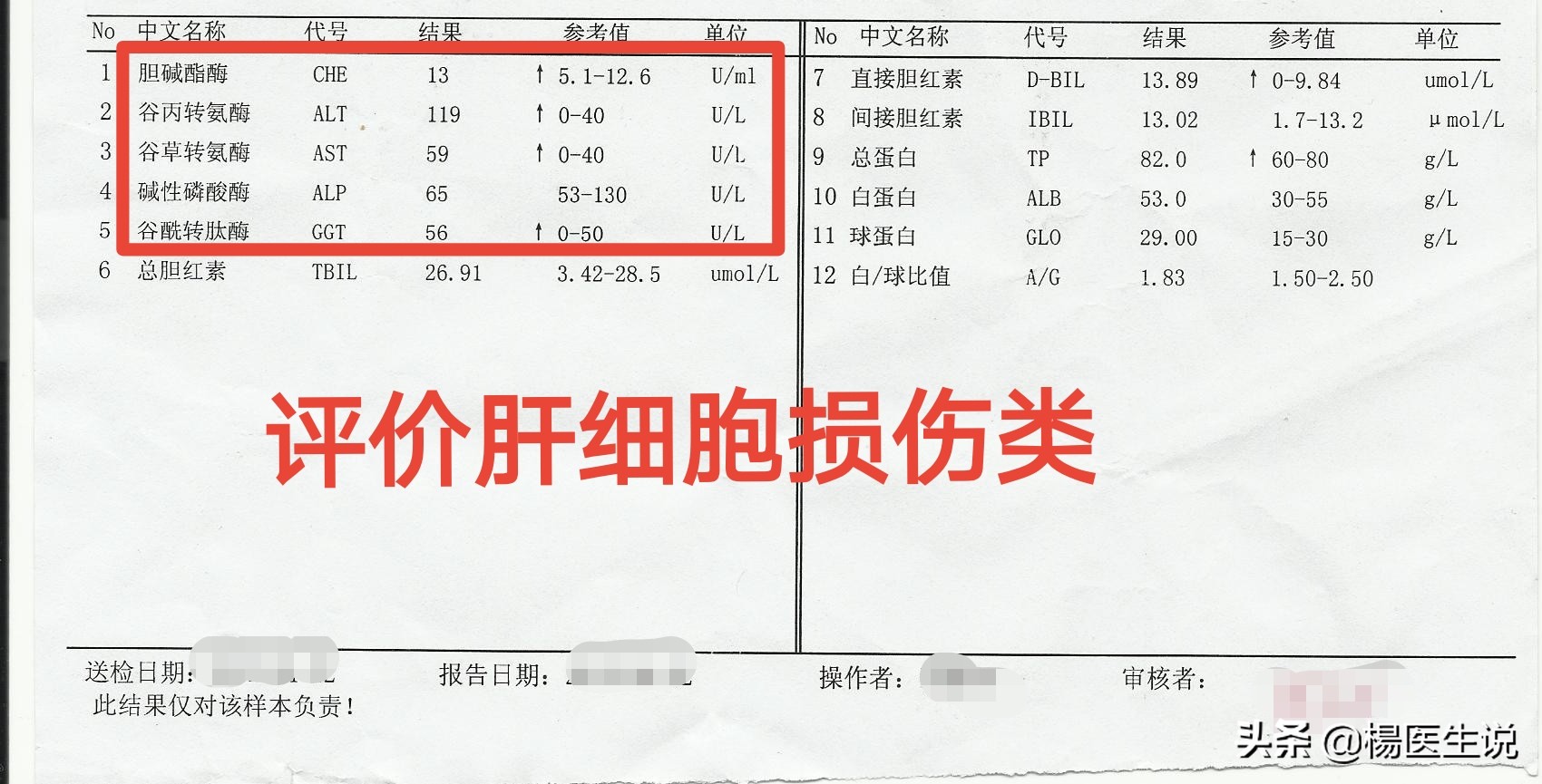 肝功能化验报告单看不懂？医生这样分析，一目了然