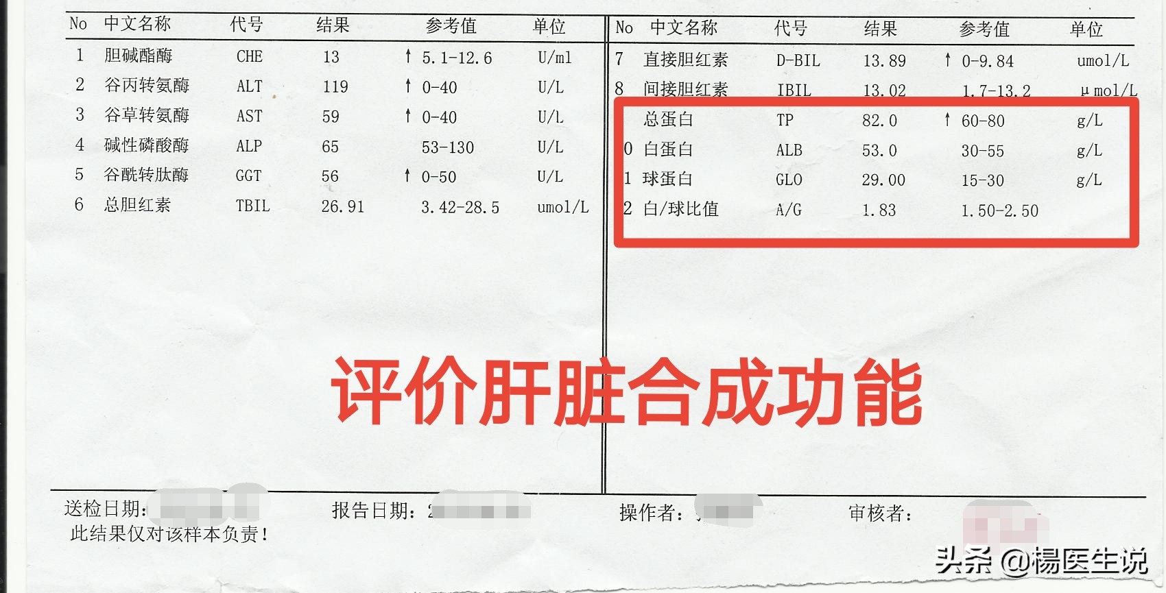 肝功能化验报告单看不懂？医生这样分析，一目了然