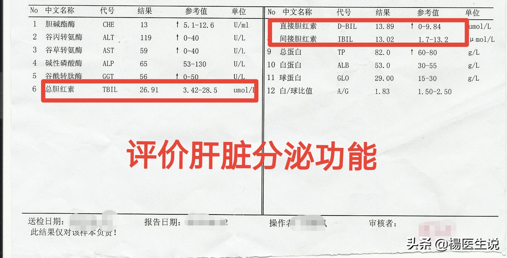 肝功能化验报告单看不懂？医生这样分析，一目了然