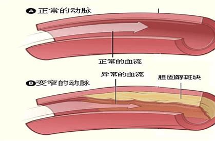 糖尿病前期不是糖尿病，对身体没有什么不良影响！医生辟谣讲清楚