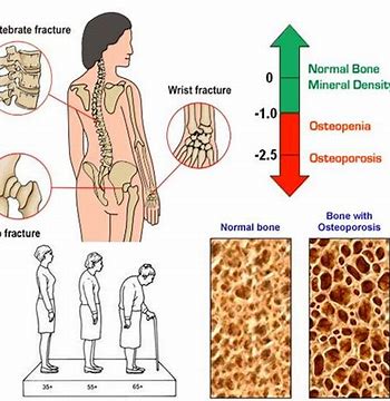 50多岁女性感觉疼痛、焦虑，都是因为更年期吗？医生为您讲清楚