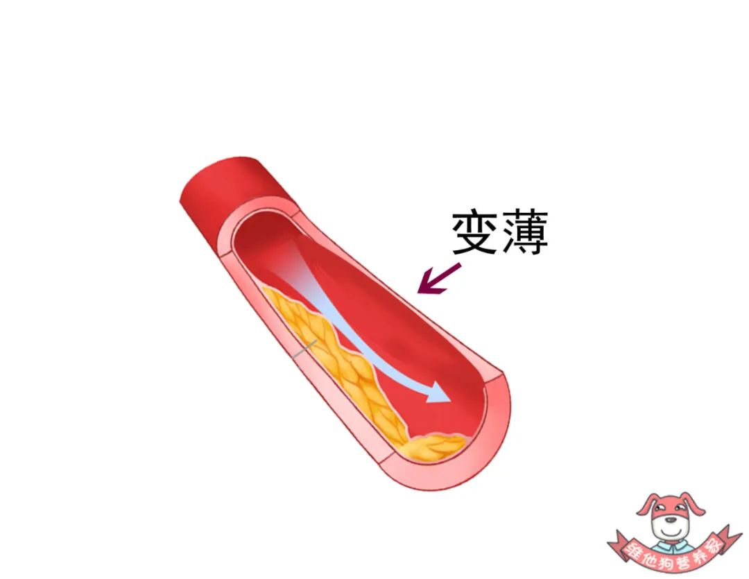 胆固醇越低越好？它的危害可比你想象中要严重