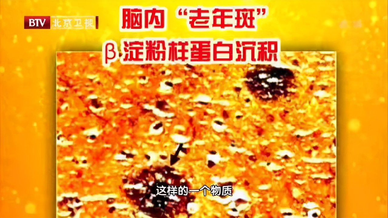 这些事会让大脑堆满“垃圾”，引发老年痴呆！三招“清扫”法，还你“干净”大脑