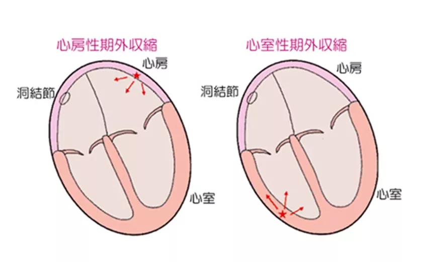 经常心慌，心律不齐，晚上容易害怕，该怎么调养呢？